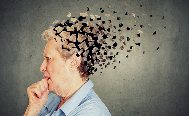 Alzheimer Yaşlanmanın Kaçınılmaz Sonu Değil!