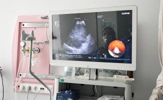 Akciğer Kanseri Tanısında Modern Yöntem